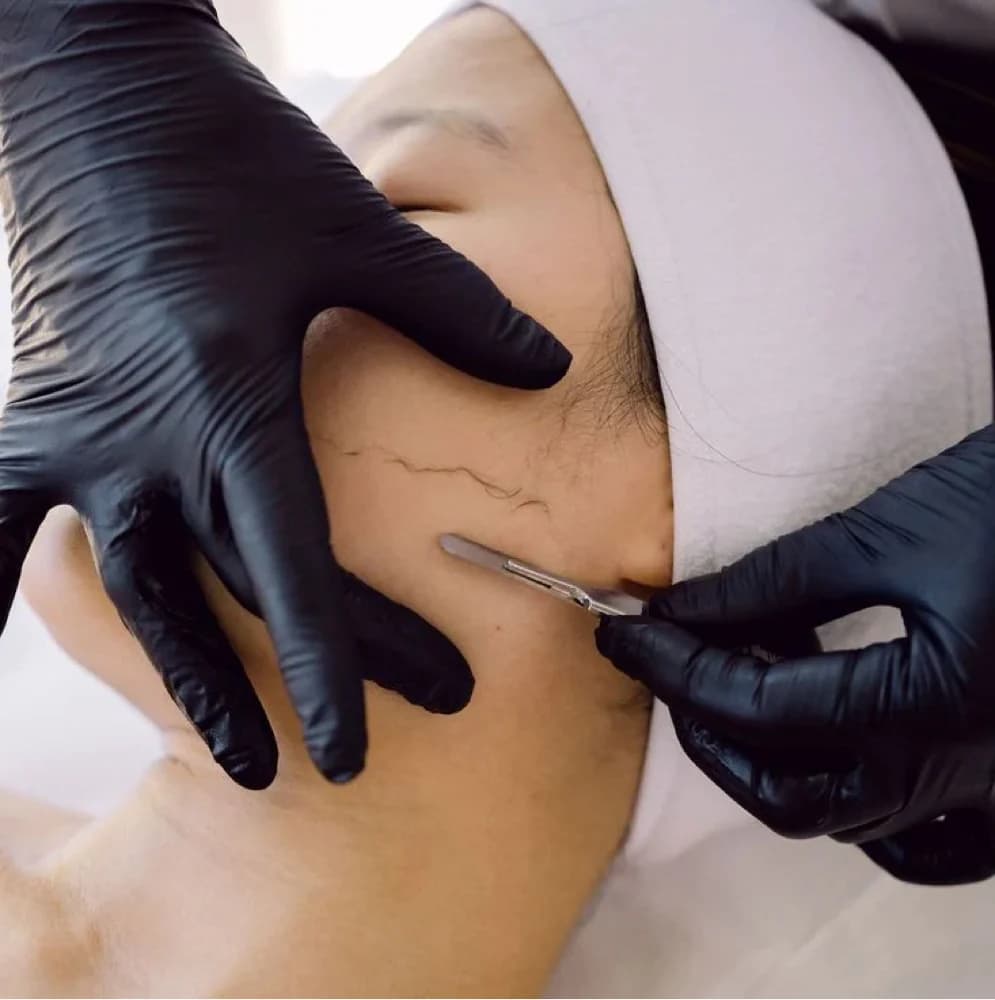 Express Dermaplane