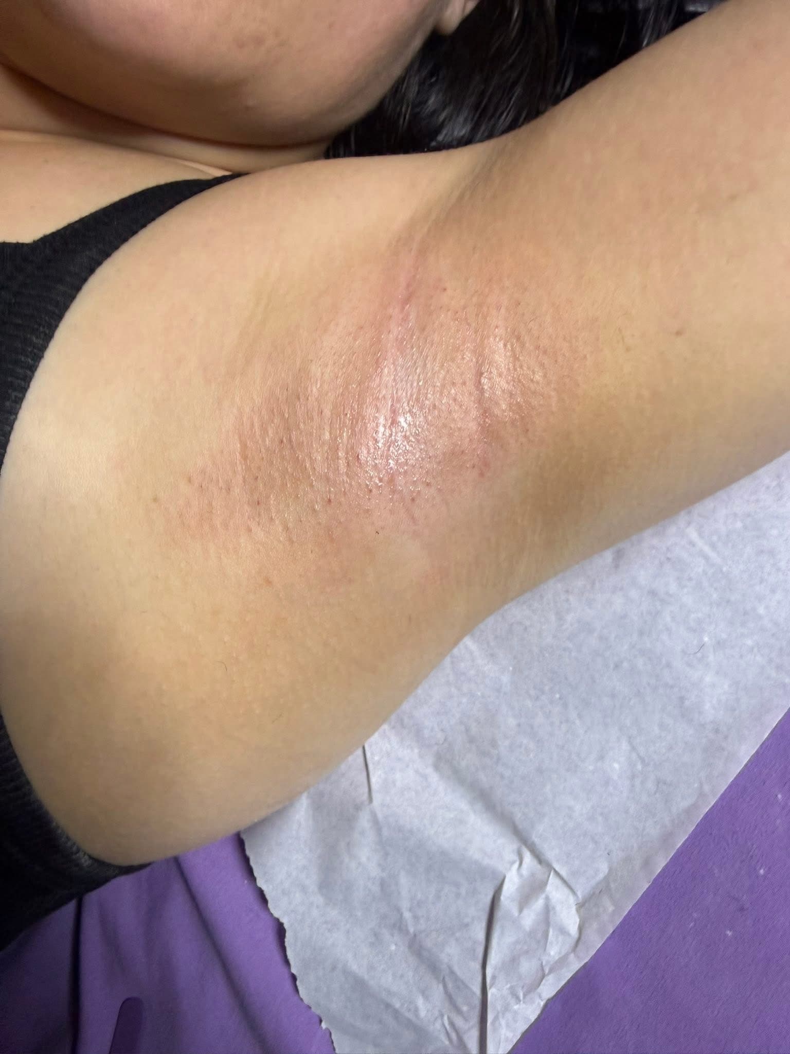 Underarm Wax at Pretty Face Esthetics